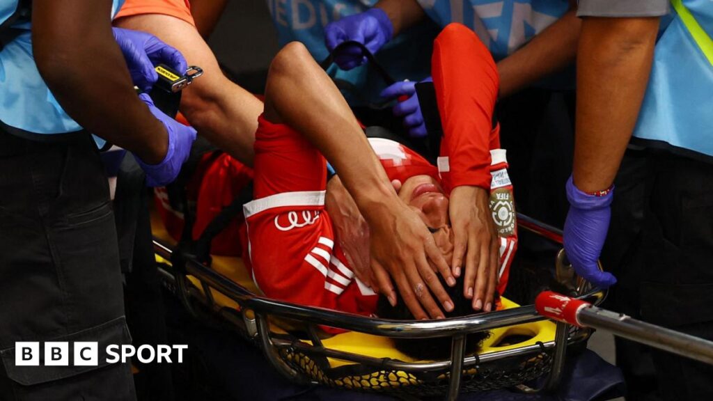 Bayern Munich: Jamal Musiala out for ‘long period’ with broken leg and dislocated ankle