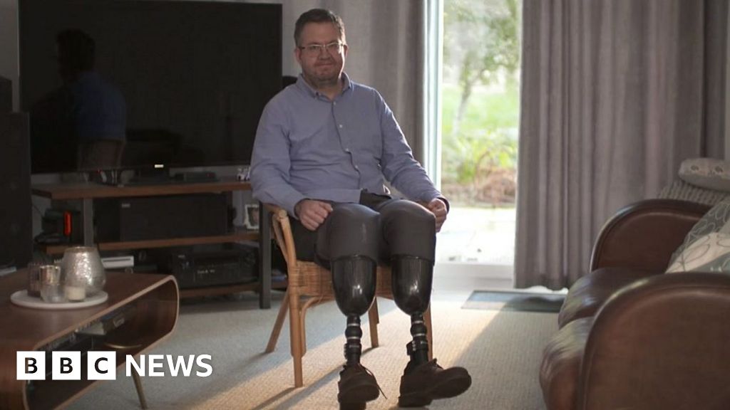 Truro surgeon accused of fraud over his leg amputations Truro surgeon accused of fraud over his leg amputations