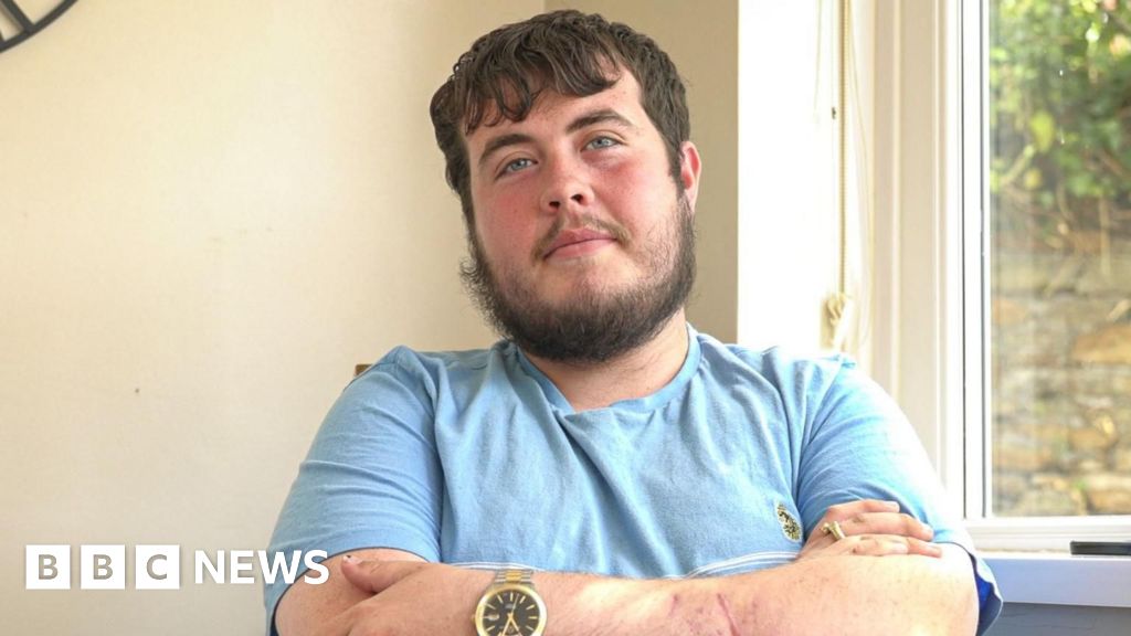 Cardiff man says triple dog attack has left him with nightmares