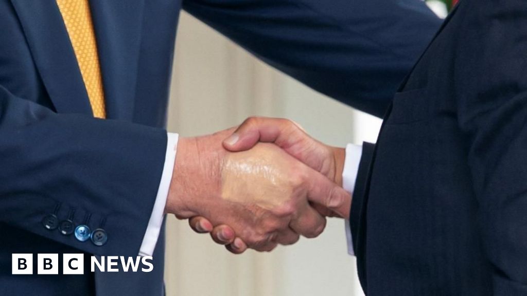 What is Trump’s vein condition and how serious is it?