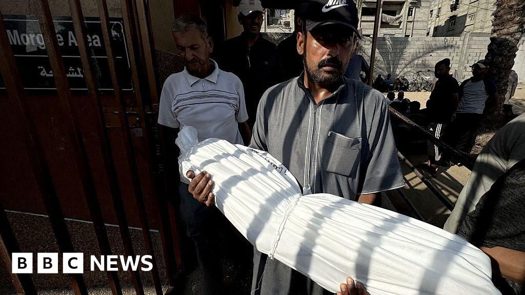 Gaza health ministry says 33 people died from malnutrition in 48 hours Gaza health ministry says 33 people died from malnutrition in 48 hours