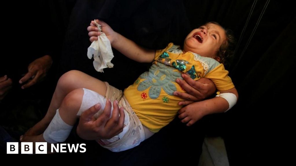 Government plans to bring more Gazan children to UK for treatment