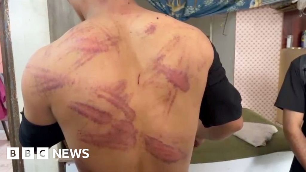 Iran drives out 1.5 million Afghans, with some branded spies for Israel