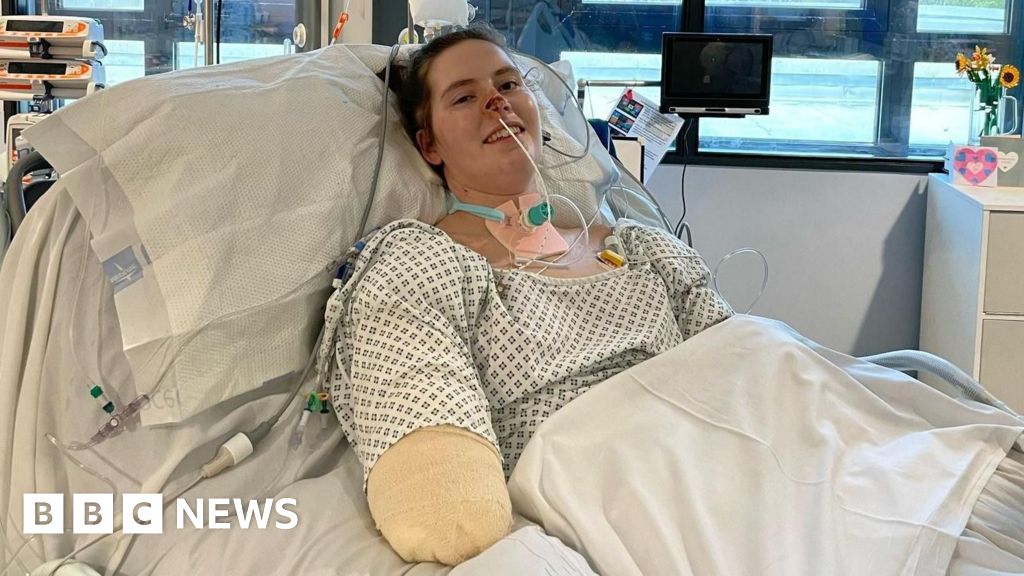 Sepsis leaves Cardiff medical student facing life with no limbs