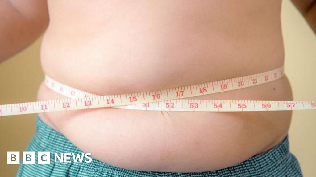 More children are obese than underweight, Unicef warns