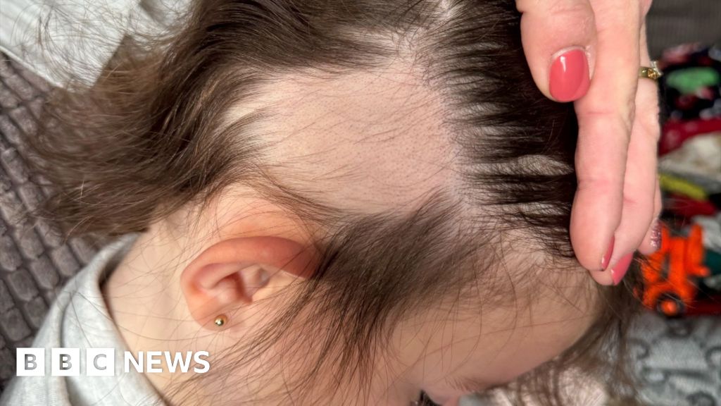 Mum’s warning after Temu brush rips out child’s hair Mum’s warning after Temu brush rips out child’s hair