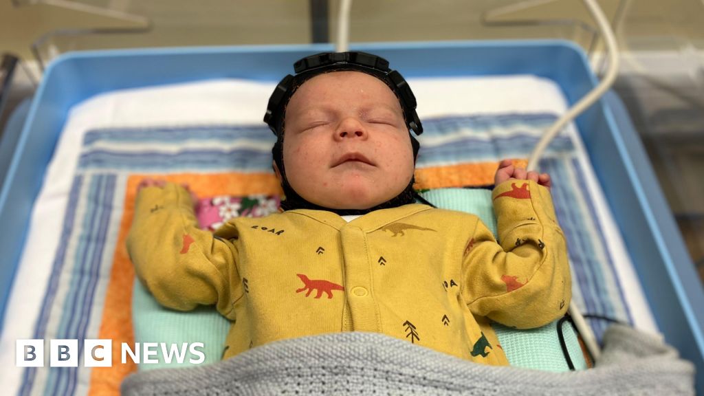 Cambridge ‘swimming cap’ brings hope for brain-injured babies Cambridge ‘swimming cap’ brings hope for brain-injured babies