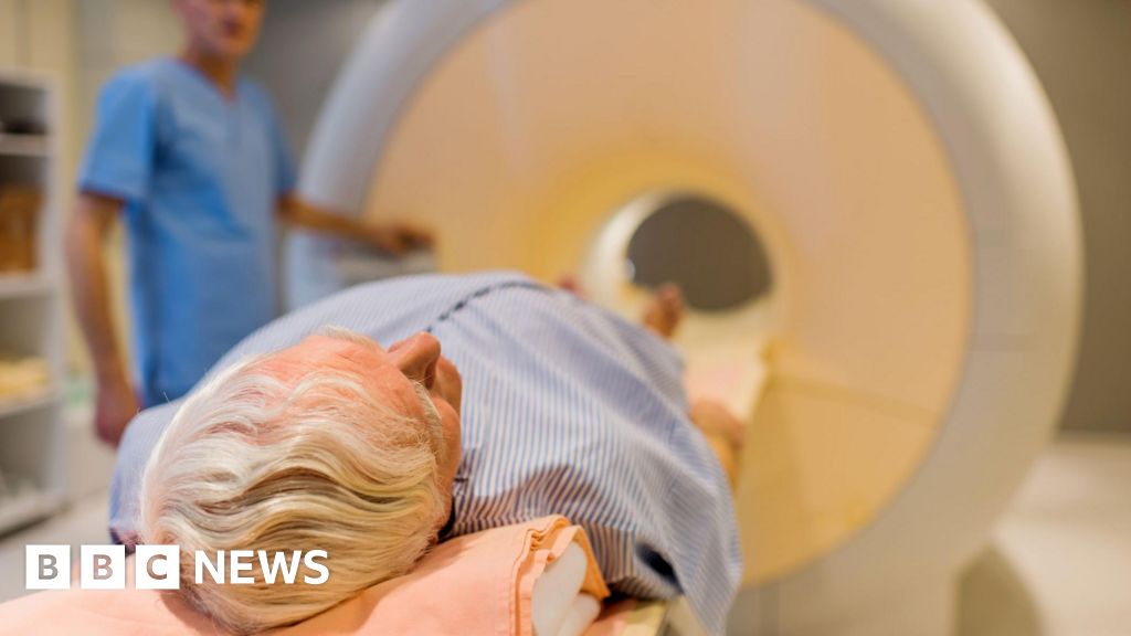 Prostate cancer screening trial to recruit thousands of men Prostate cancer screening trial to recruit thousands of men