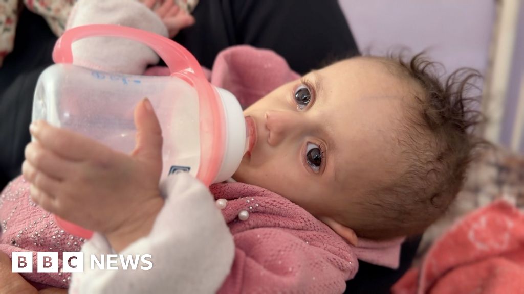Baby Siwar back in hospital in Gaza after returning from treatment in Jordan