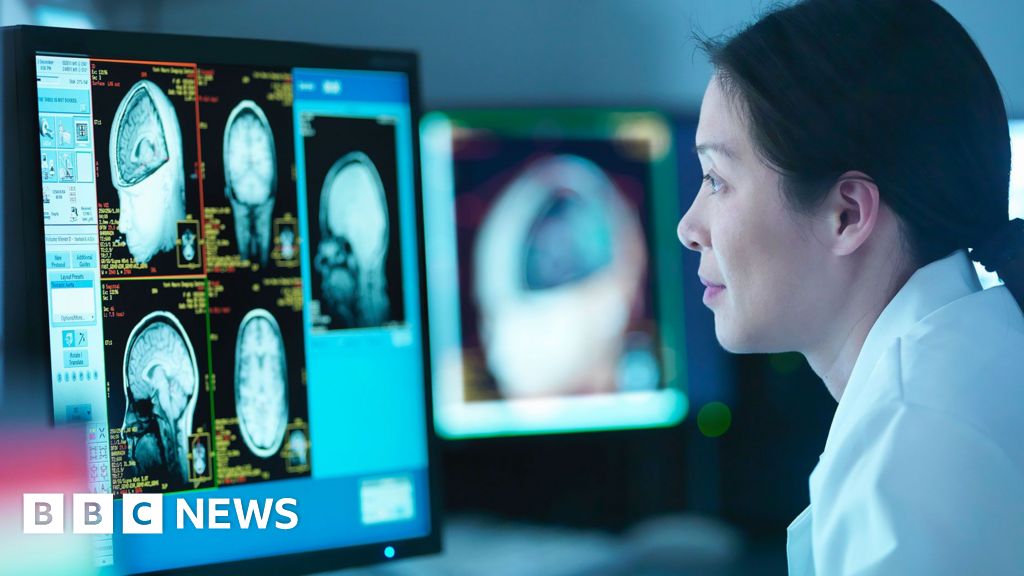 Menopause linked to Alzheimer’s-like brain changes Menopause linked to Alzheimer’s-like brain changes