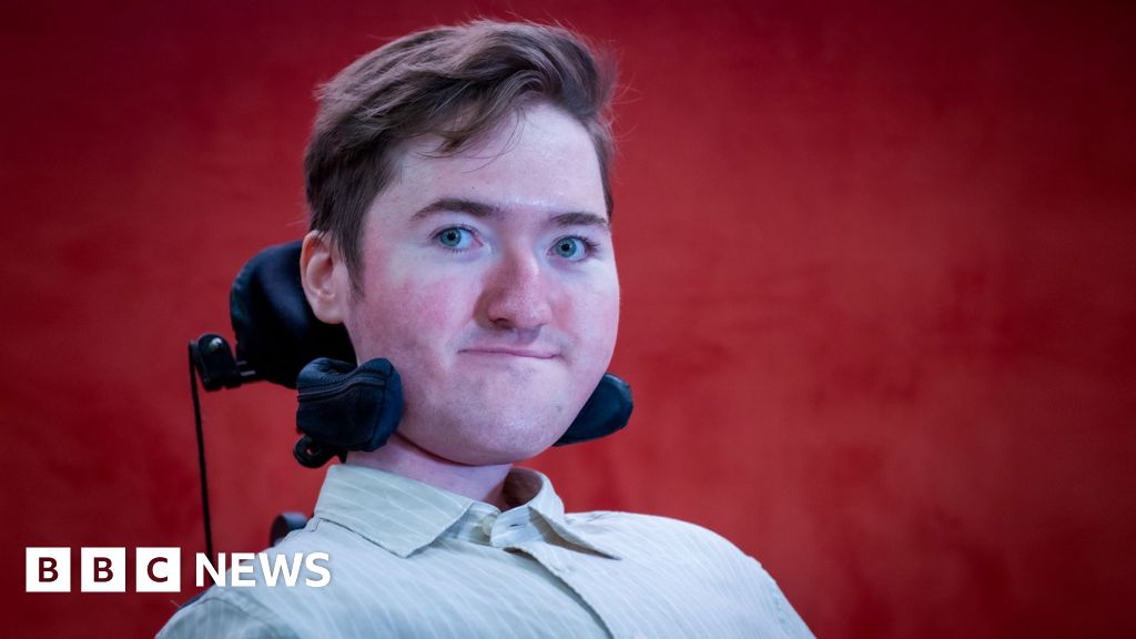 Jessy Nelson spoke about SMA this week Jessy Nelson spoke about SMA this week