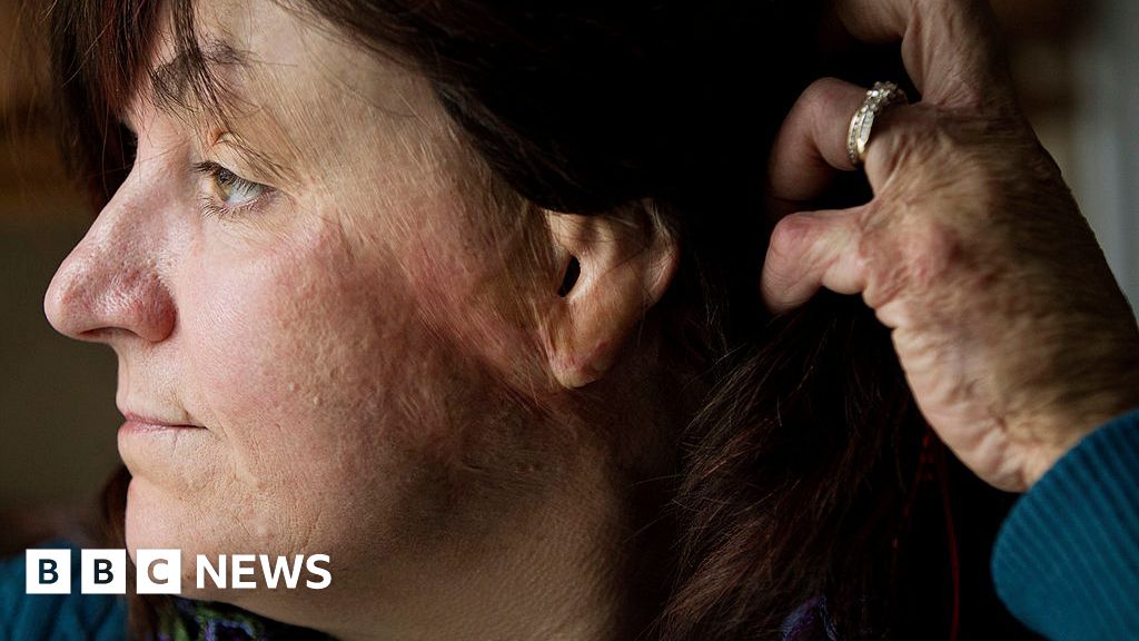 What to know about ‘flashover fire’ dangers